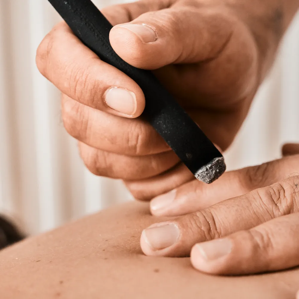 Trattamento di moxibustione, medicina tradizionale cinese, alla scuola Punto Riflesso